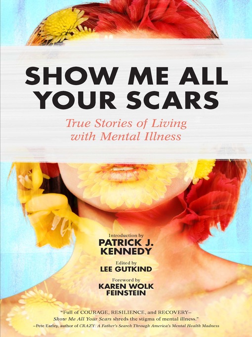 Title details for Show Me All Your Scars by Lee Gutkind - Available